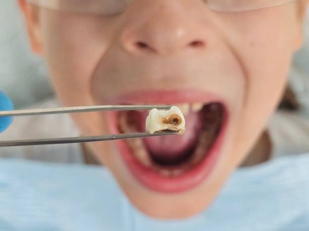 Best Emergency Treatment for Jaw Pain or Injury in Lake Mohegan, NY
